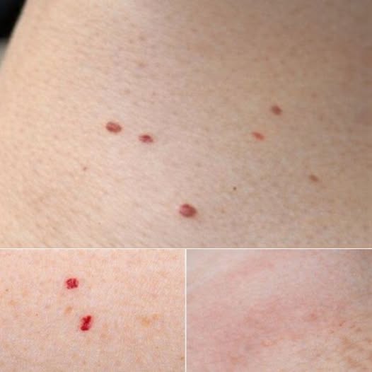 Understanding Red Spots on the Skin: Causes, Care, and When to Pay Attention